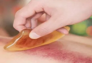 Wie lange dauert es, bis die Ekchymose nach Gua Sha verschwindet?
