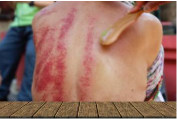 Ist mehr Druck in Gua Sha besser?