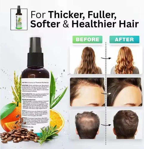 Hair Care Rosemary Oil And Rice Water Hair Growth Spray Serum Oil