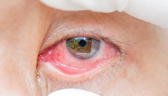 Get Soap Out of Your Eye Get Soap Out of Your Eye